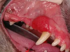 Acanthomatous ameloblastoma