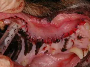 Acanthomatous ameloblatoma post op