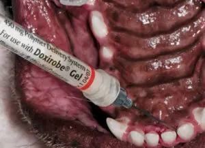 5-application-of-Doxirobe-into-the-pocket