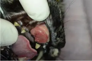 Squamous Cell Carcinoma