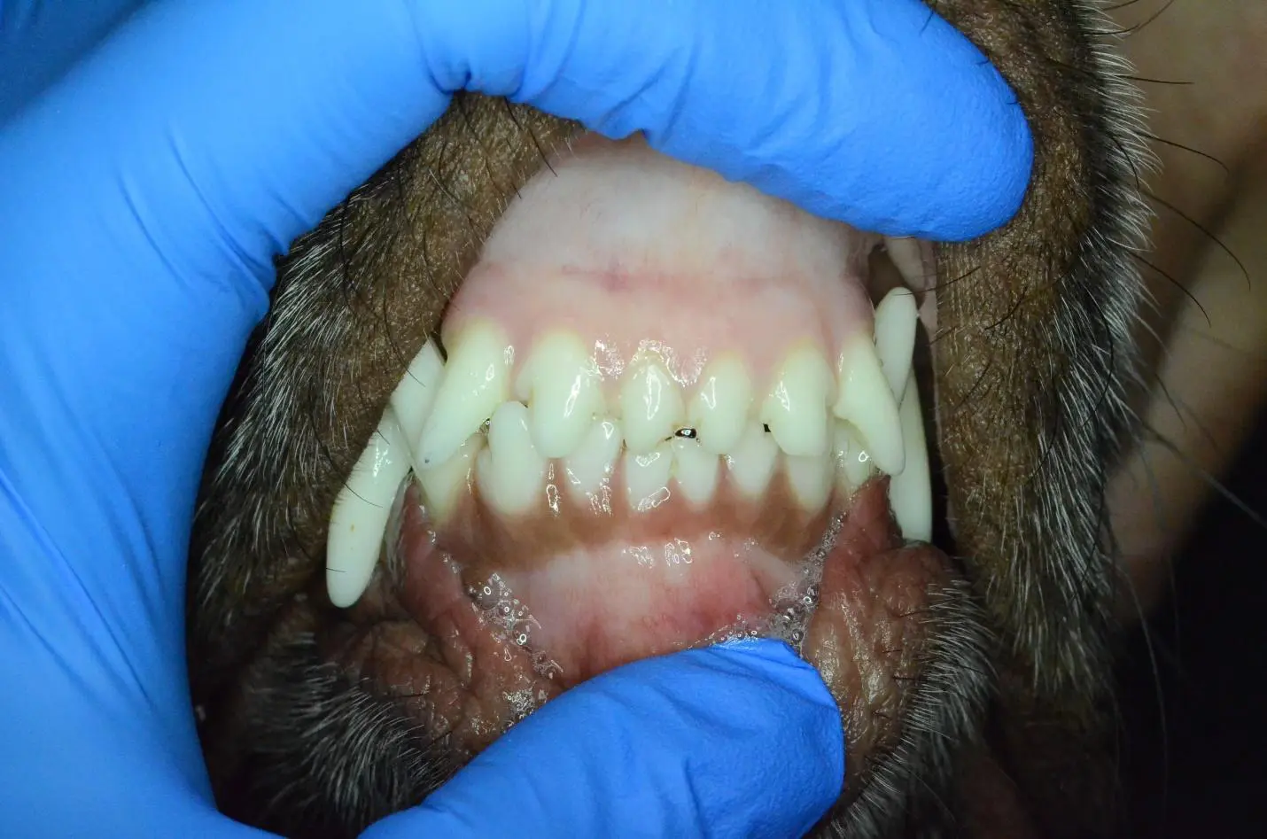 Normal occlusion – maxilla (upper jaw) sits slightly in front of the mandible (lower jaw)