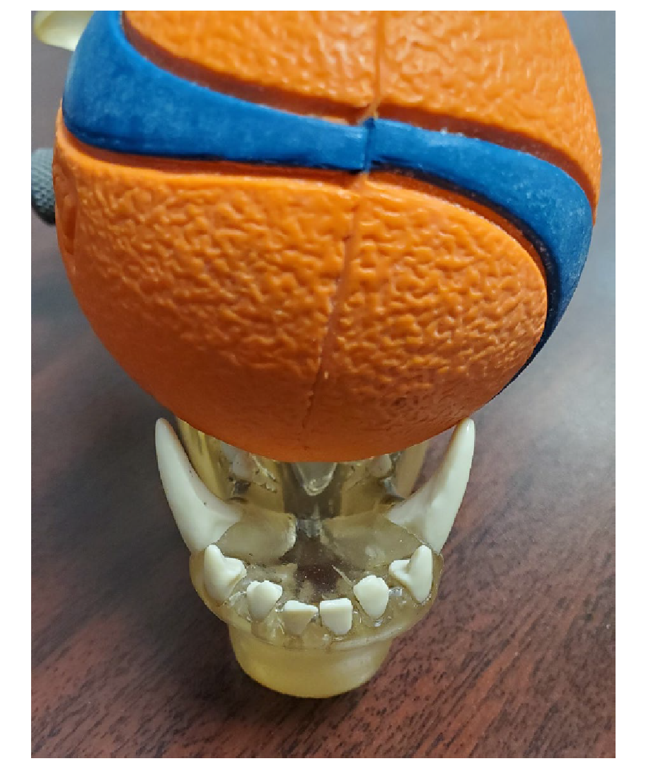 Example of a properly fitted ball for attempting ball therapy.