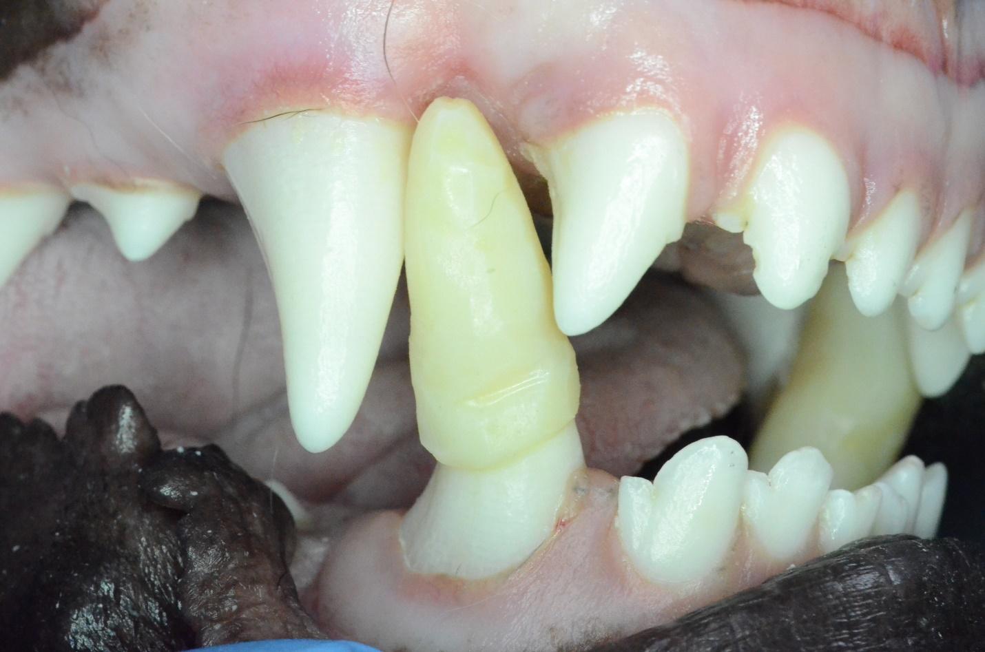 Crown extension application on the right mandibular canine