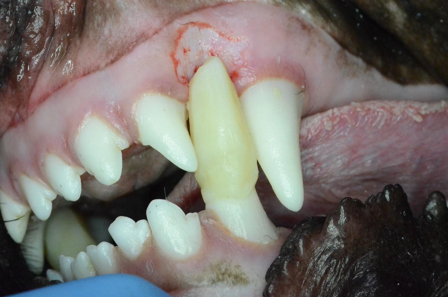 Image post crown extension fabrication on the left mandibular canine and sloping of the above gingiva 