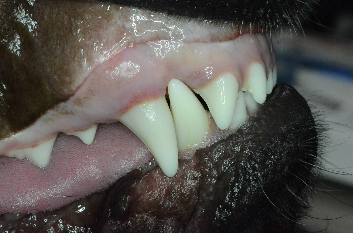Pre-therapy occlusion (left side) with the lower canine puncturing the upper jaw